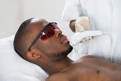 A laser can remove unwanted hair